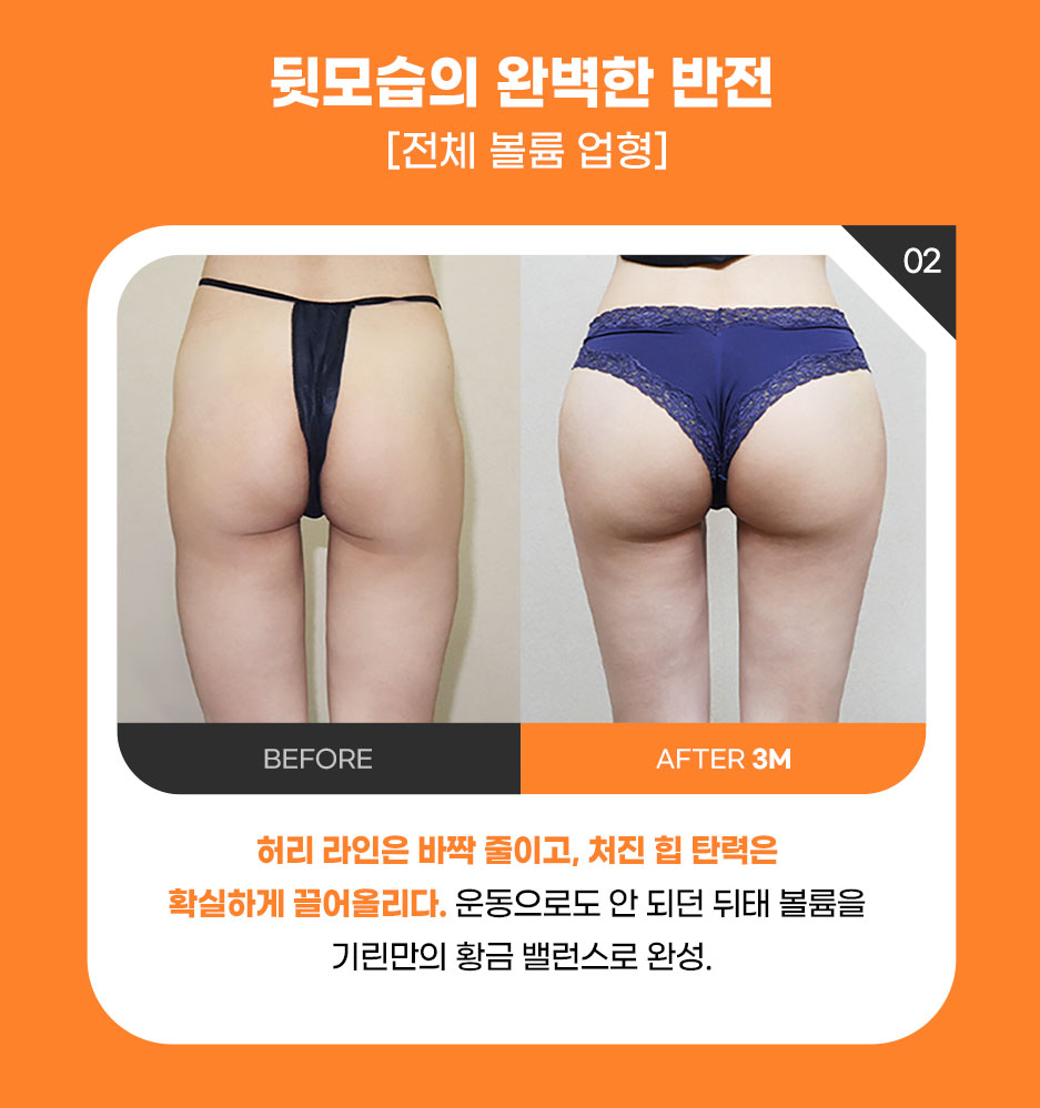엉발란스_미인하이_06.jpg