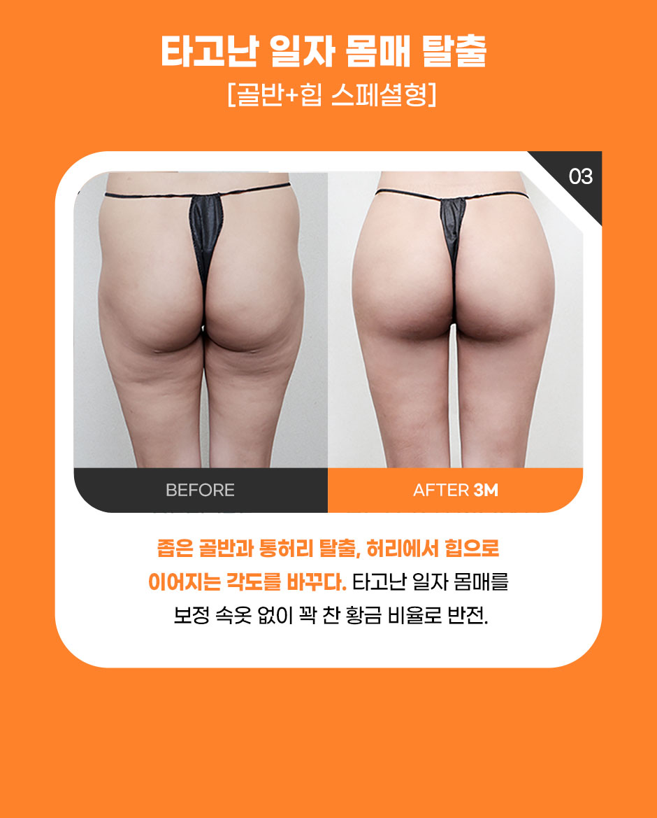 엉발란스_미인하이_08.jpg