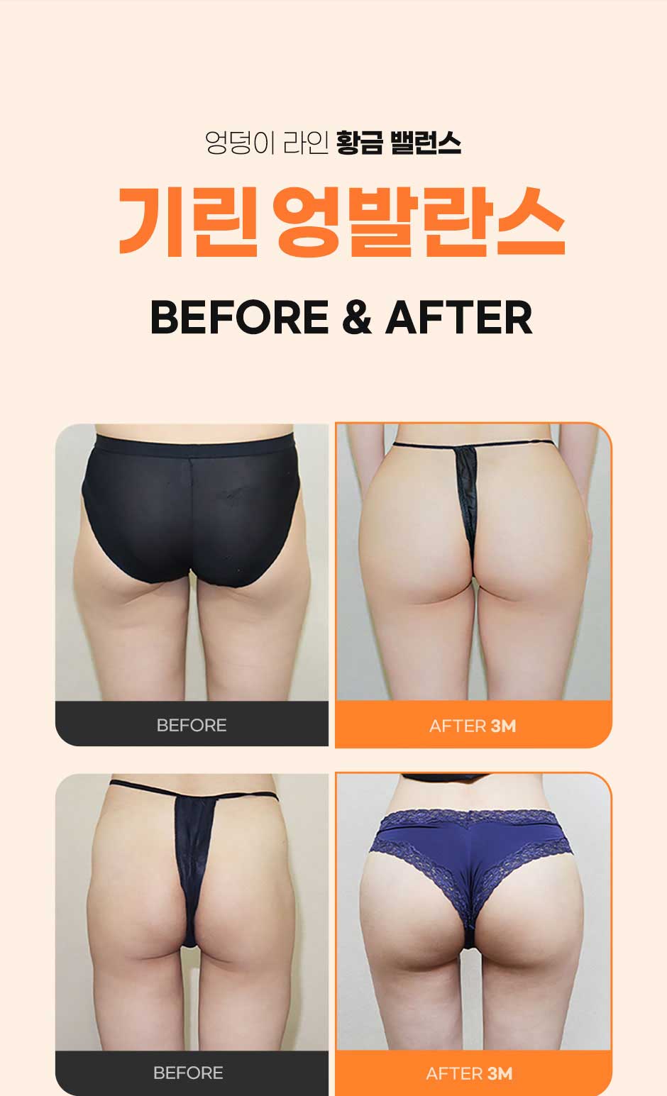 엉발란스_미인하이_09.jpg