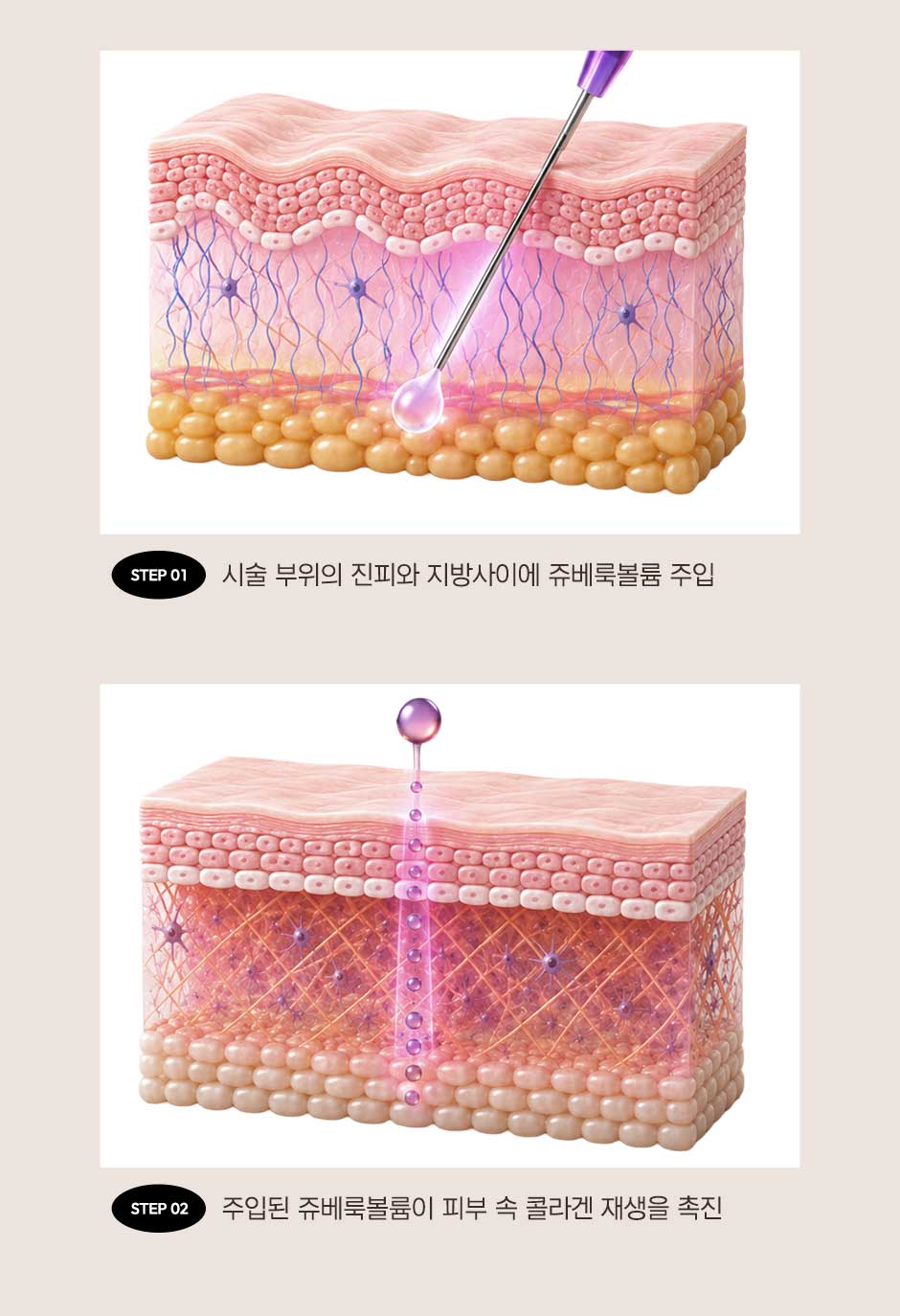 수면쥬베룩볼륨_미인하이_05.jpg