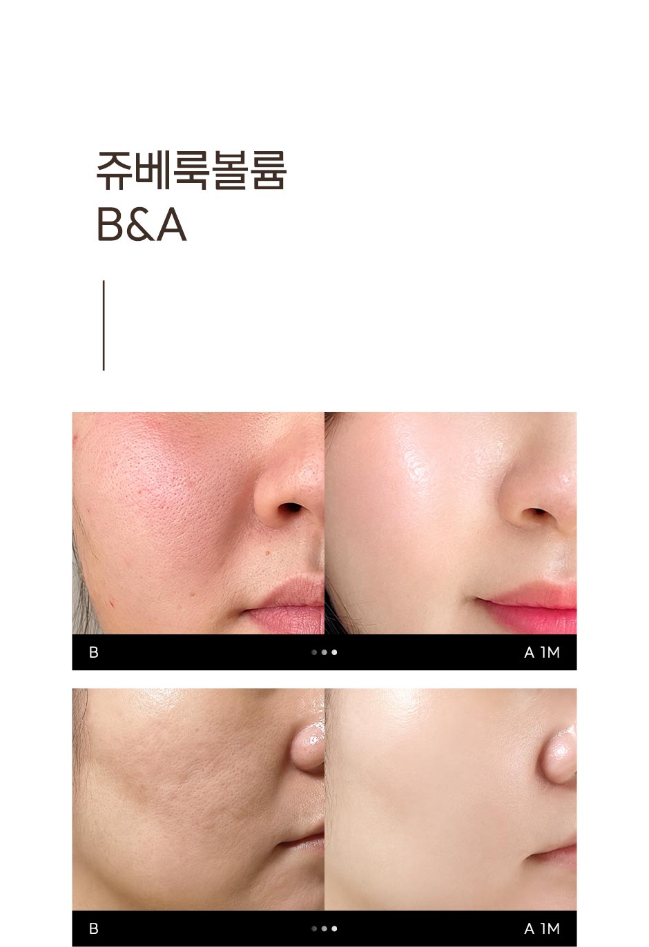 수면쥬베룩볼륨_미인하이_03.jpg