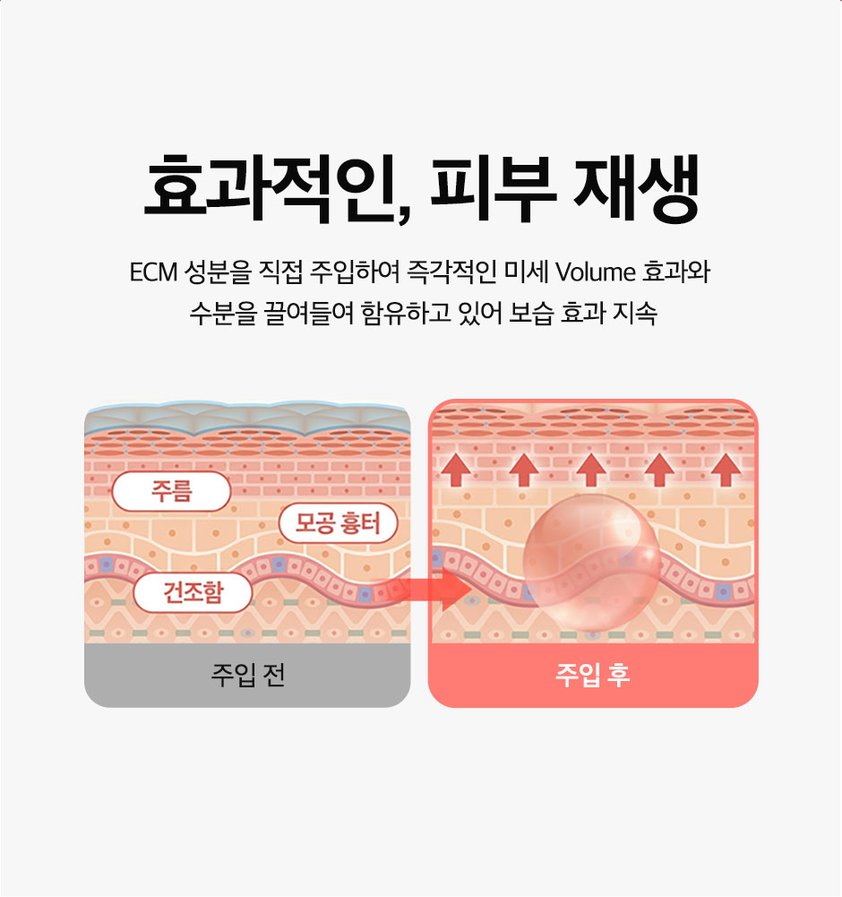 엘라비에리투오_미인하이_11.jpg