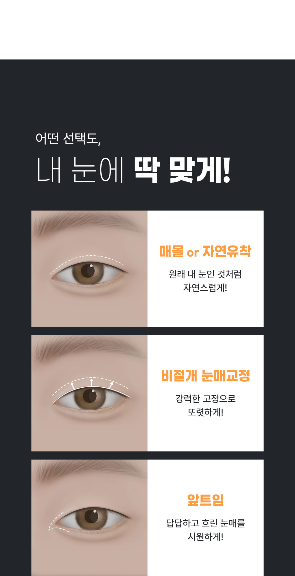 남자눈성형_08.jpg