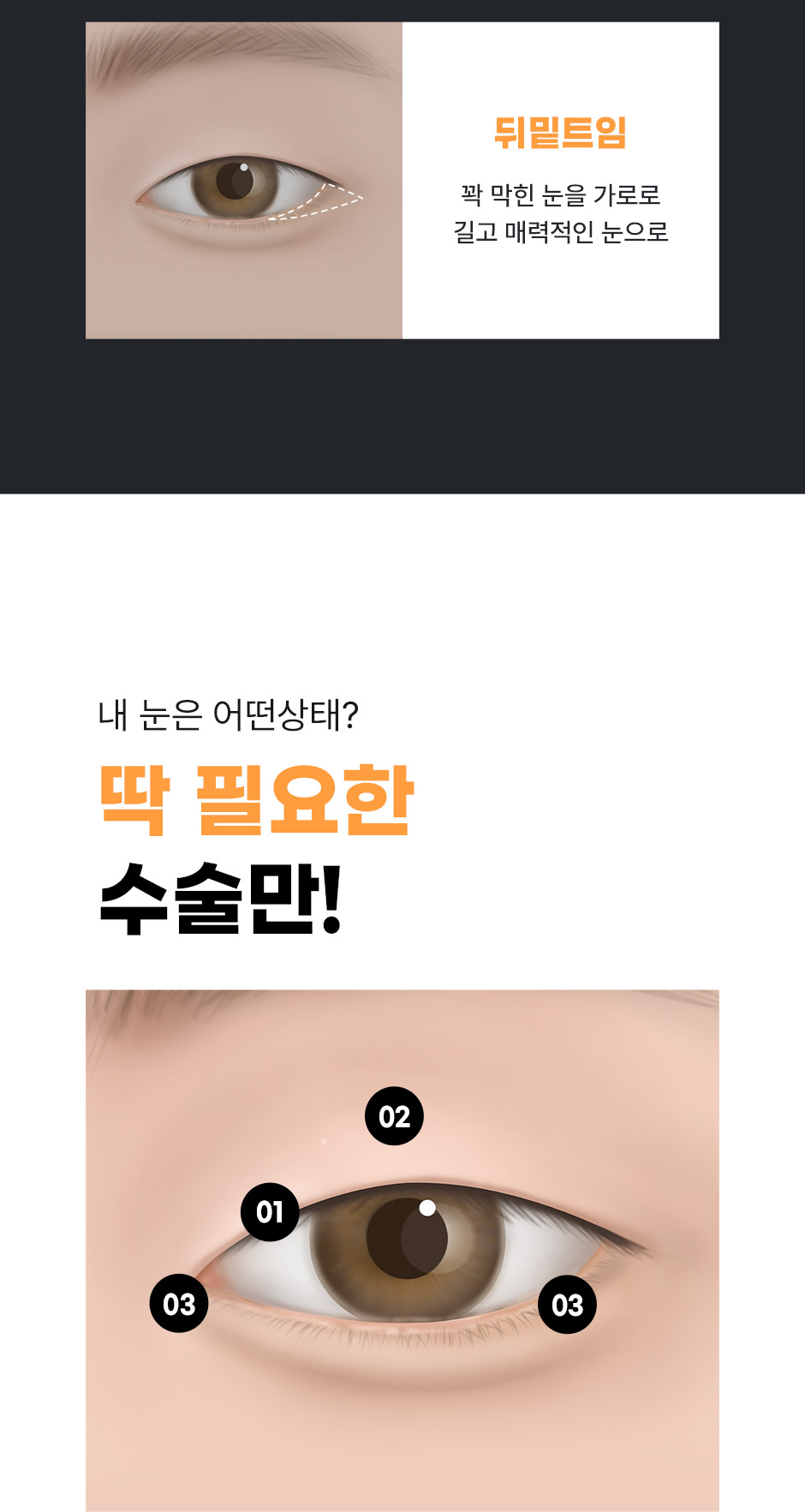 남자눈성형_09.jpg