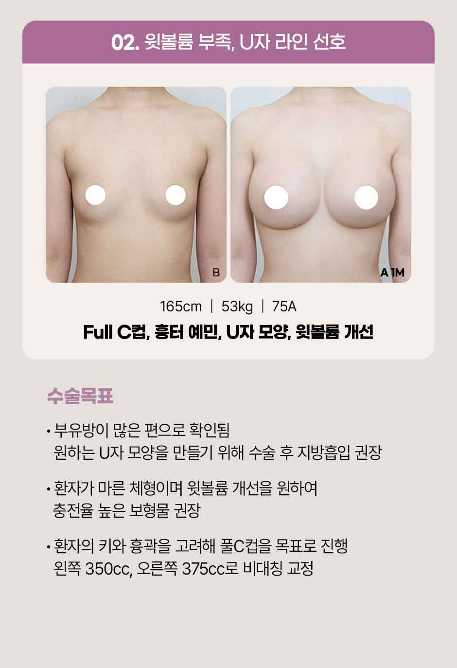 모티바_미인하이_04.jpg