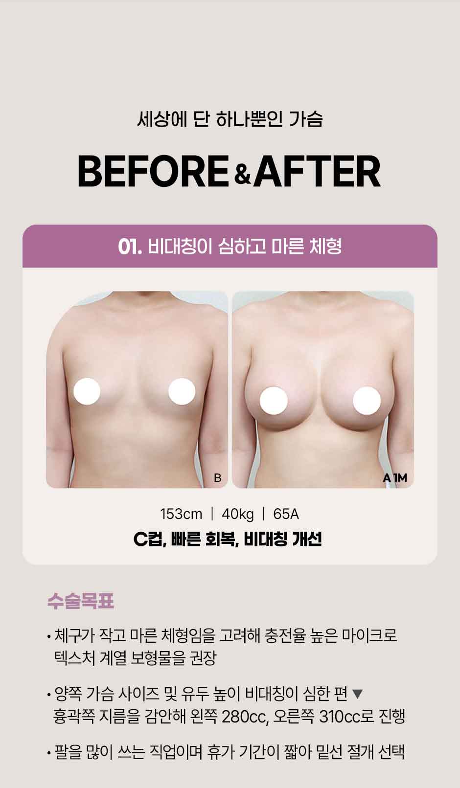 모티바_미인하이_03.jpg