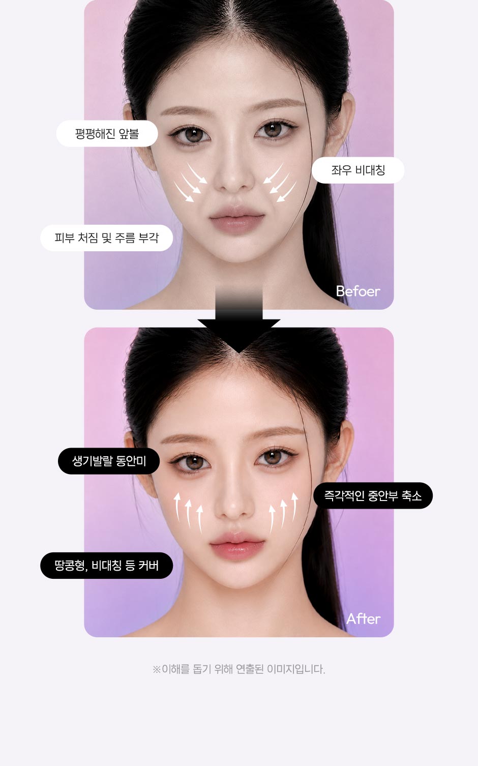 중안부리프팅_미인하이_03.jpg