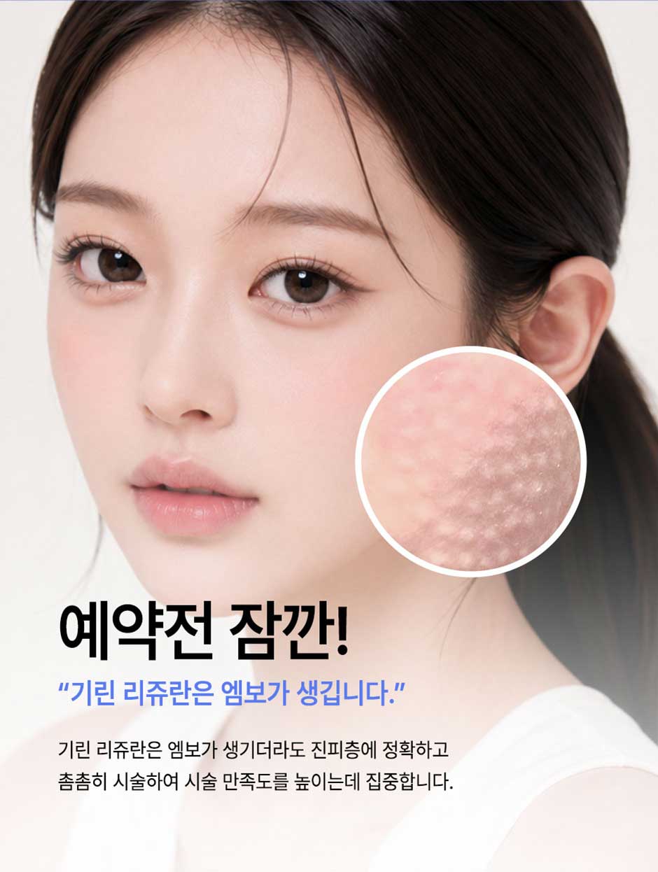 리쥬란4cc_미인하이_04.jpg