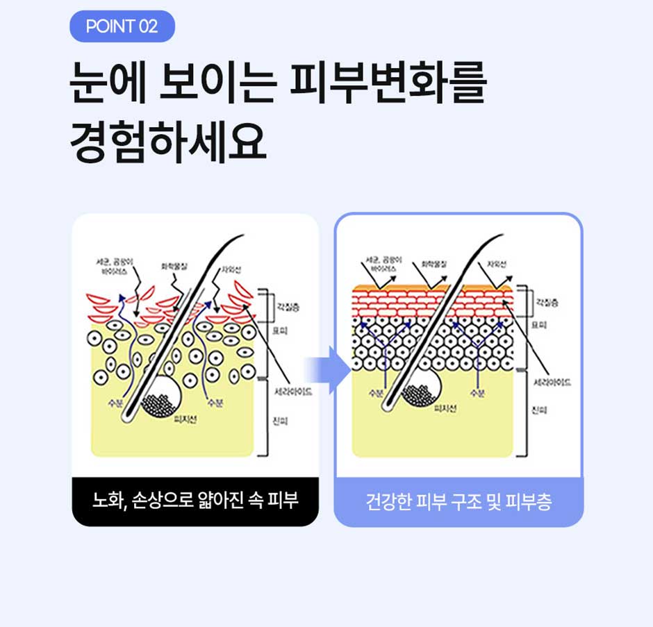리쥬란4cc_미인하이_08.jpg