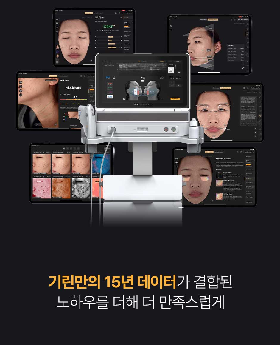 울쎄라피프라임_미인하이_04.jpg