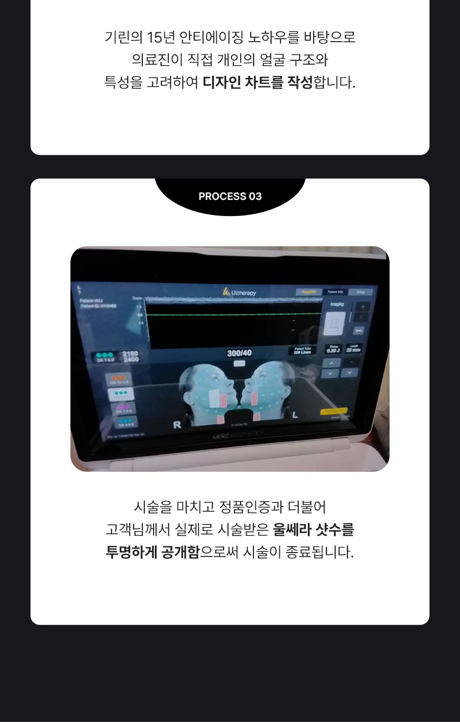 울쎄라피프라임_미인하이_06.jpg