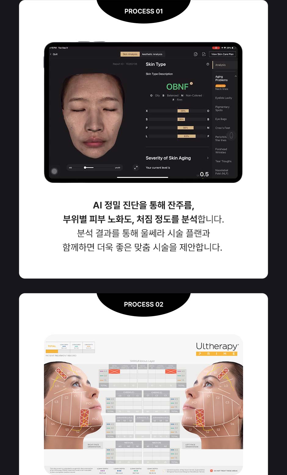 울쎄라피프라임_미인하이_05.jpg