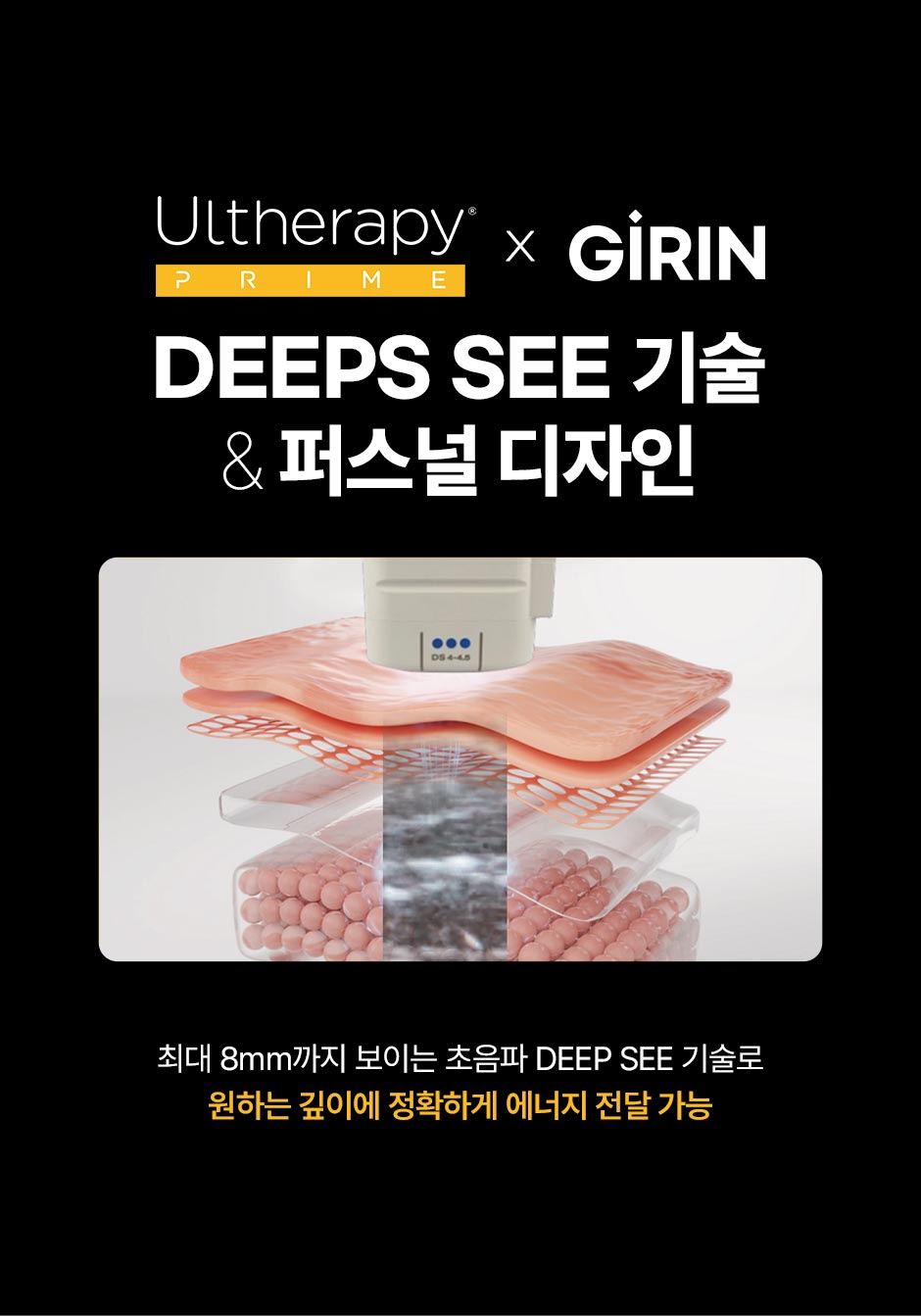 울쎄라피프라임_미인하이_08.jpg