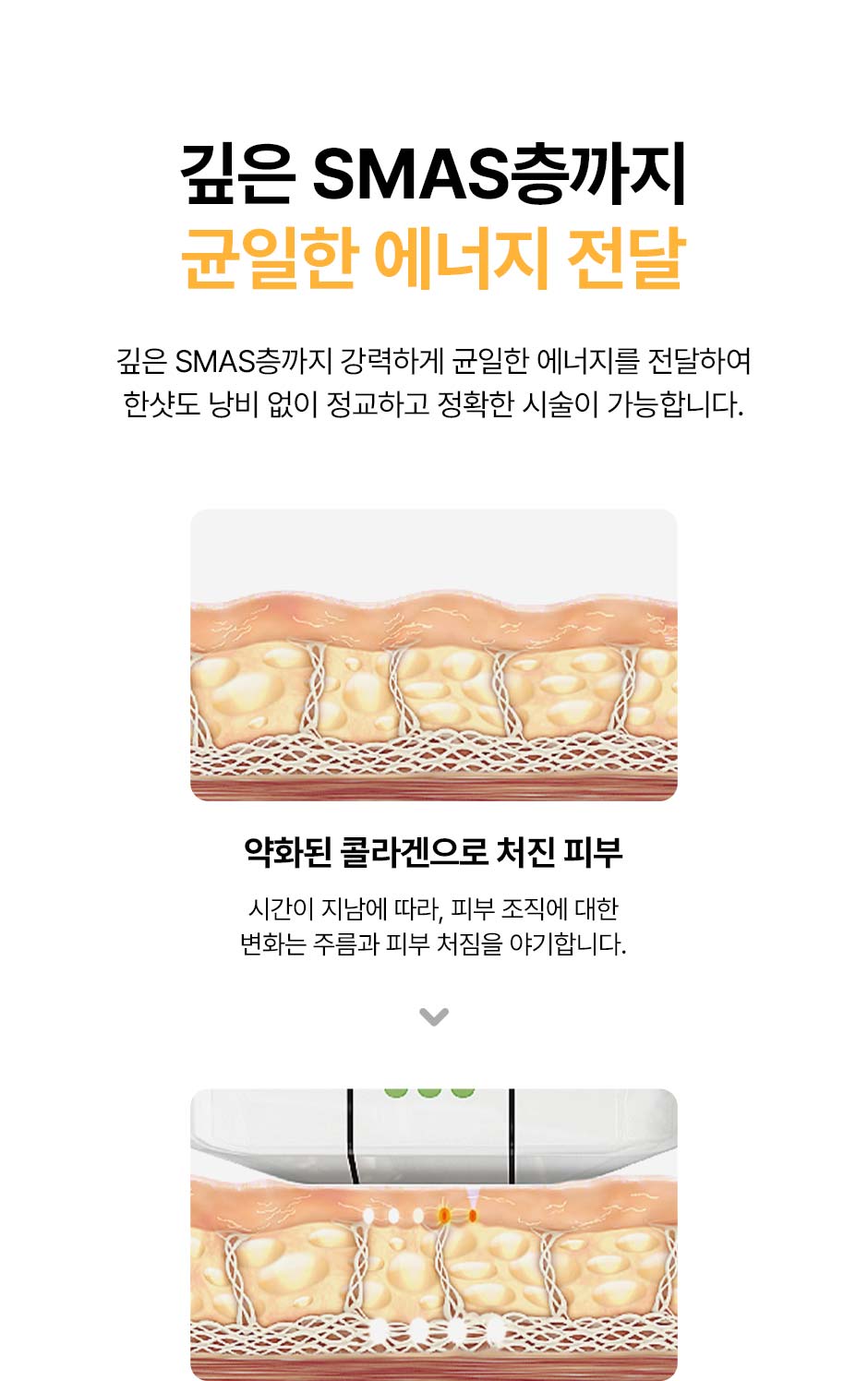 울쎄라피프라임_미인하이_10.jpg