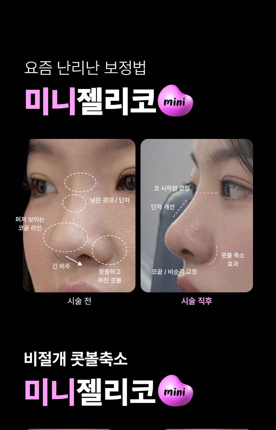 미니젤리코_미인하이_11.jpg