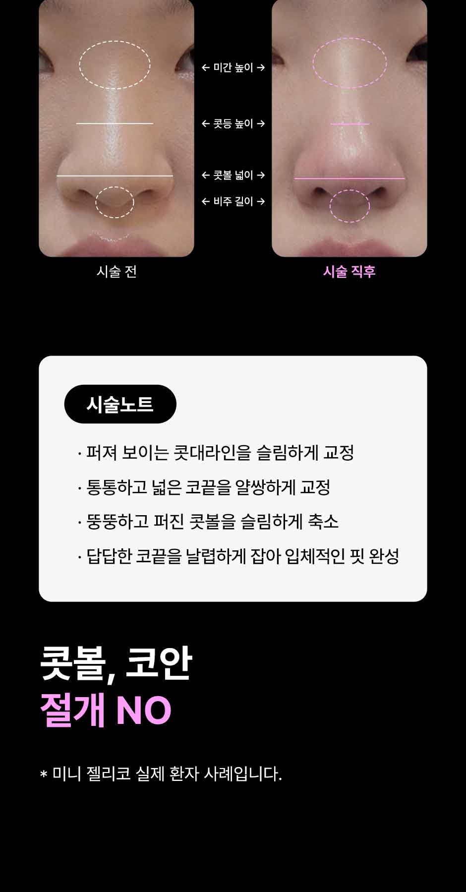 미니젤리코_미인하이_12.jpg