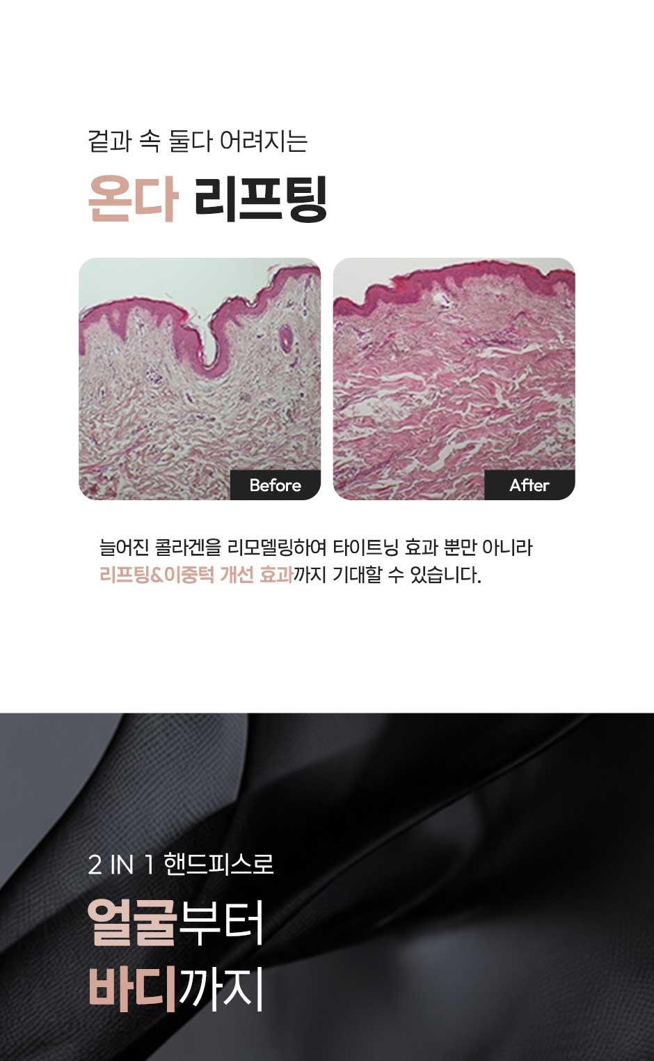 온다리프팅_미인하이_11.jpg