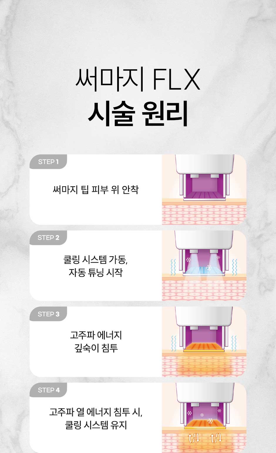 써마지리프팅_미인하이_07.jpg