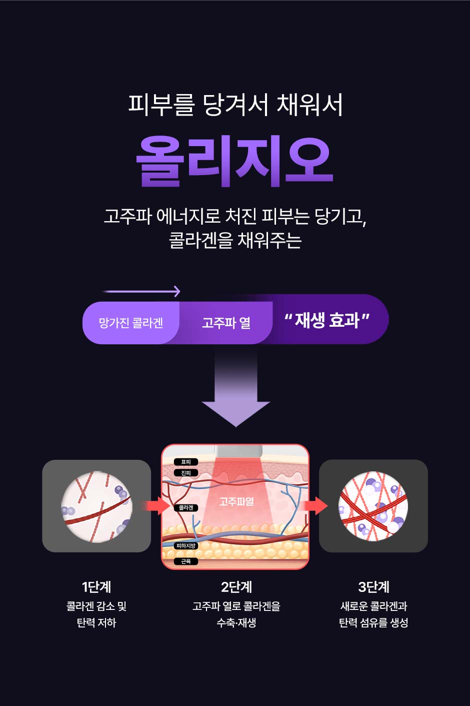 올리지오리프팅_미인하이_07.jpg