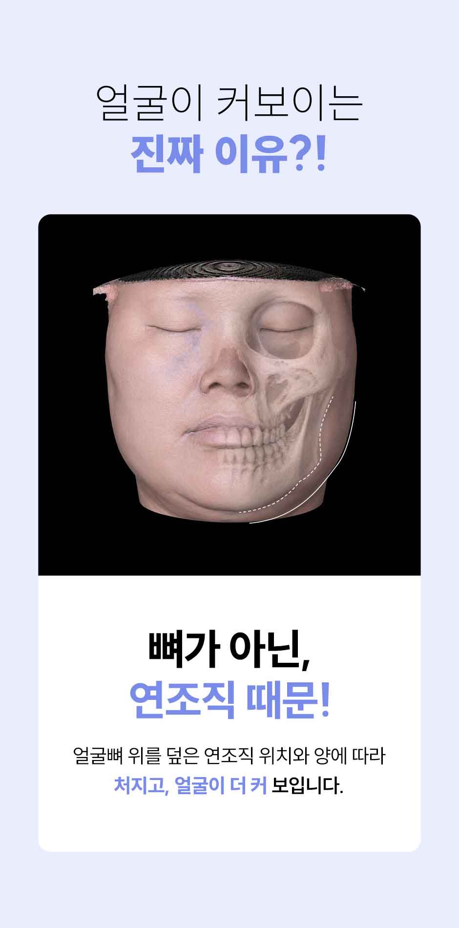 연조직윤곽술_미인하이_02.jpg