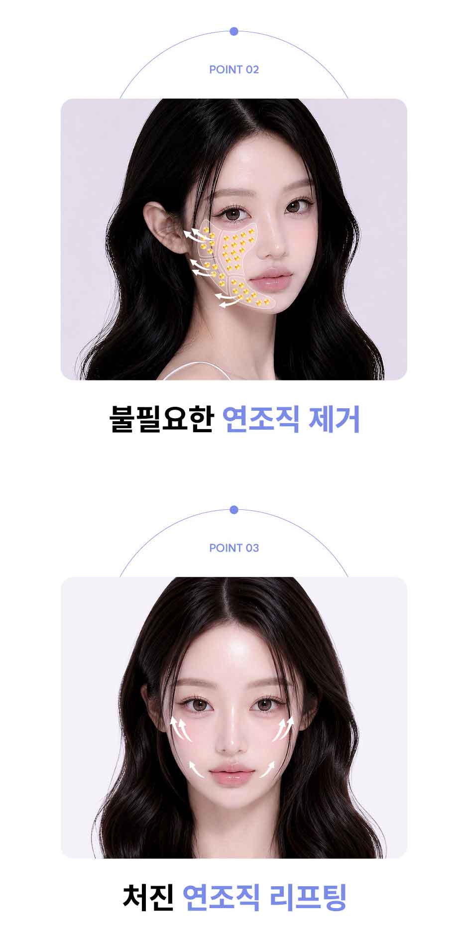 연조직윤곽술_미인하이_04.jpg