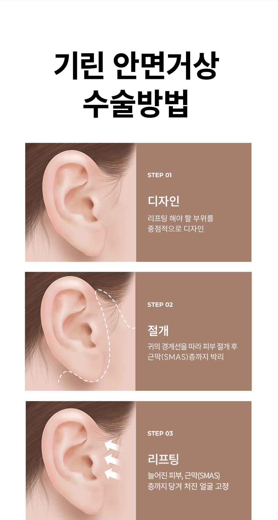 안면거상_미인하이_07.jpg