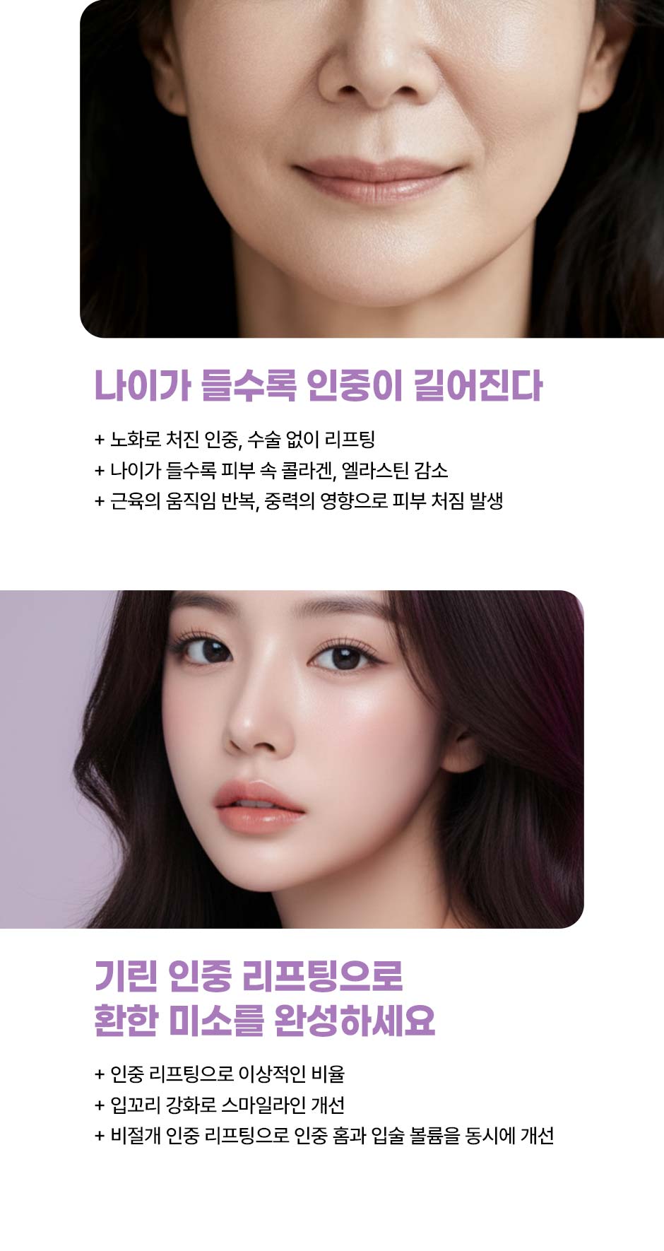 인중리프팅_미인하이_08.jpg