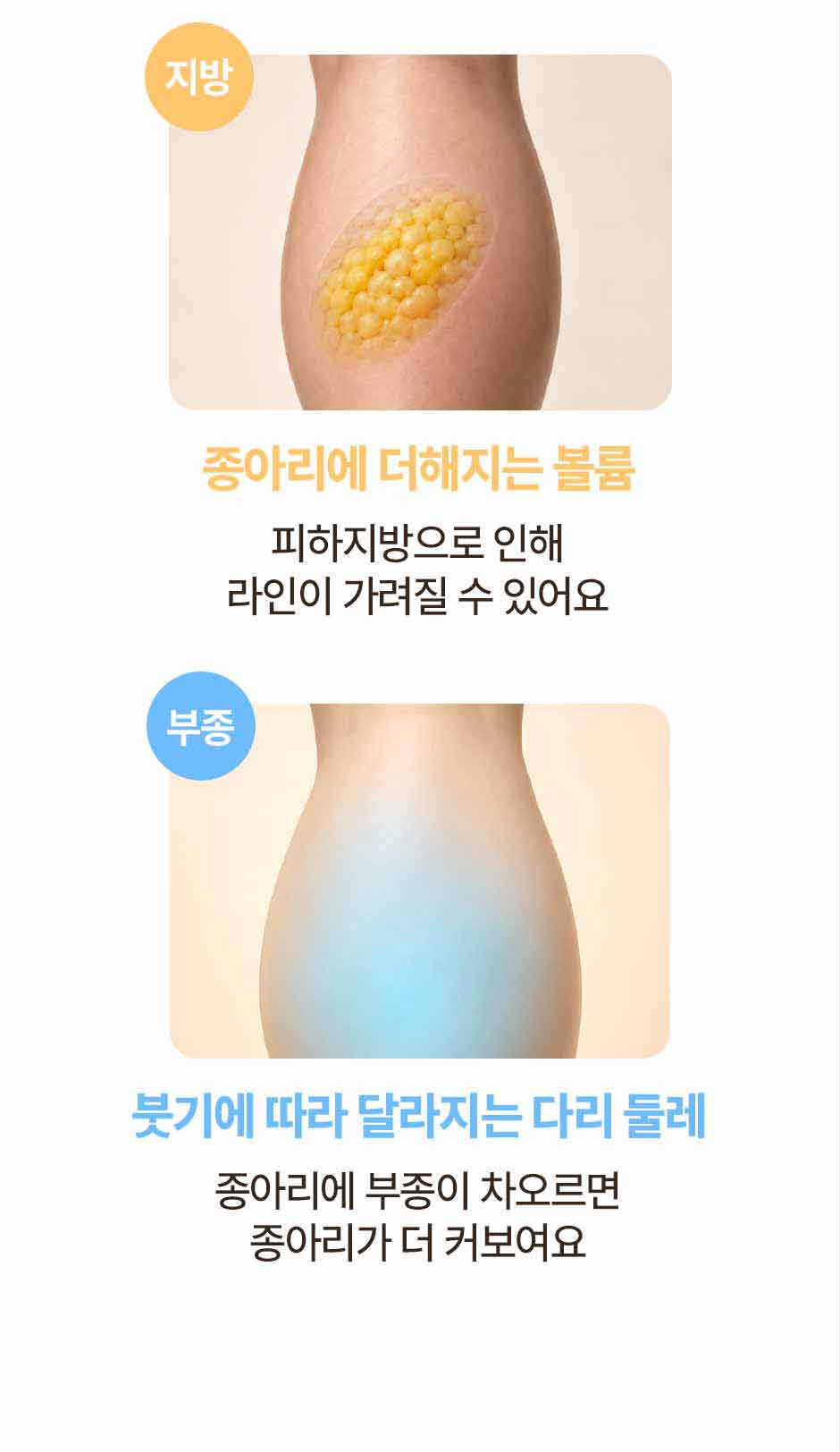 260917_알피스주사_미인하이03_02.jpg