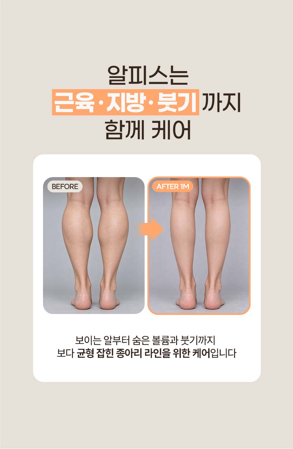 260917_알피스주사_미인하이04.jpg