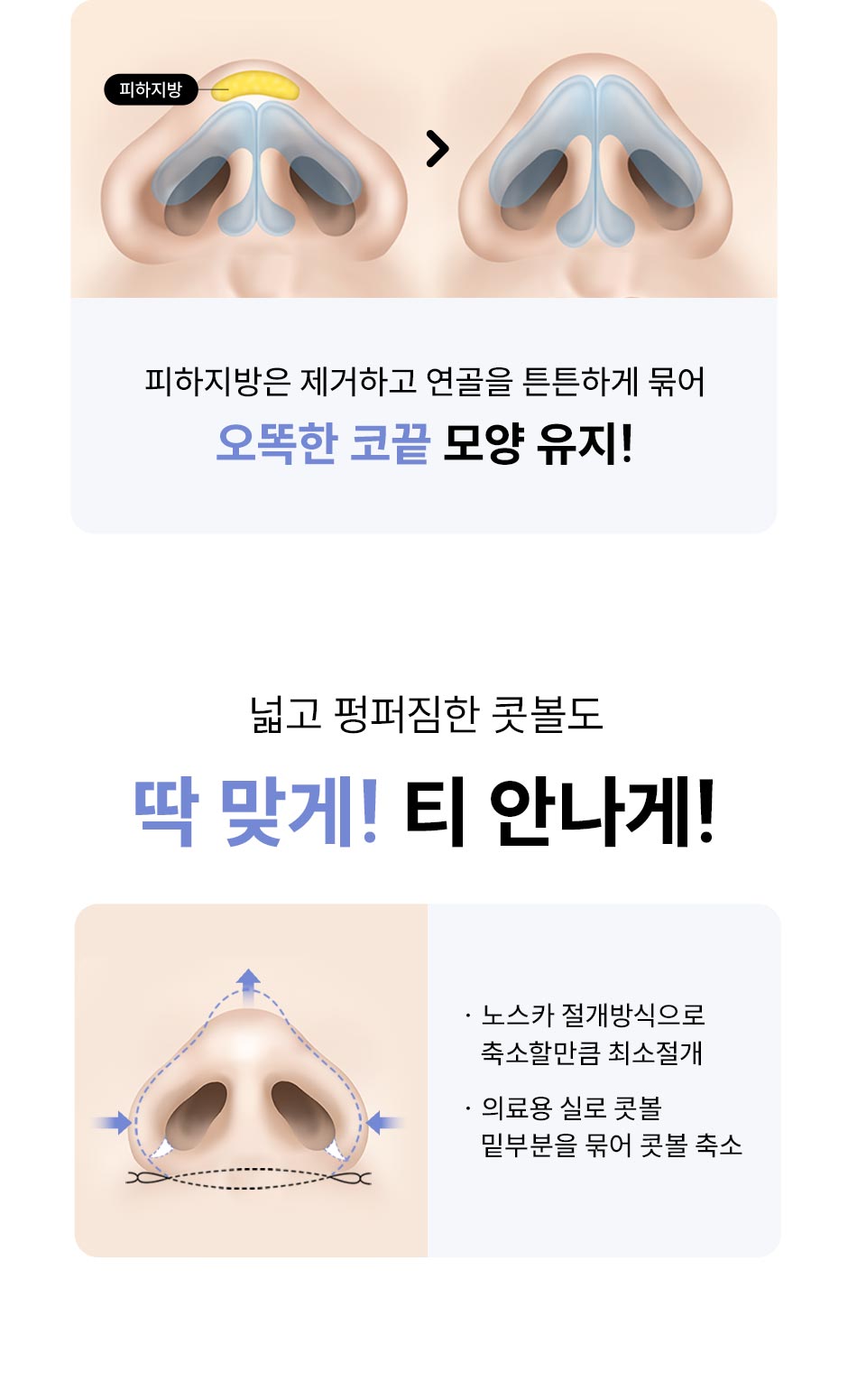 첫코성형_미인하이_05.jpg