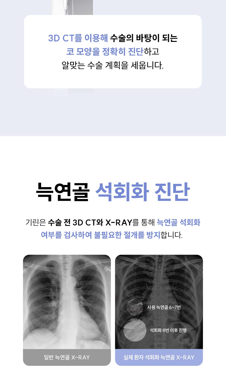 첫코성형_미인하이_14.jpg