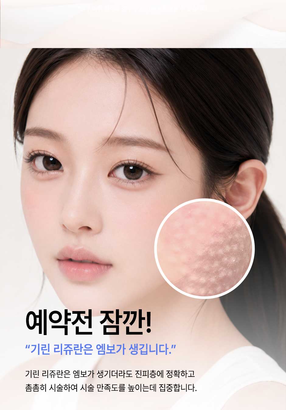 리쥬란4cc_미인하이_02.jpg