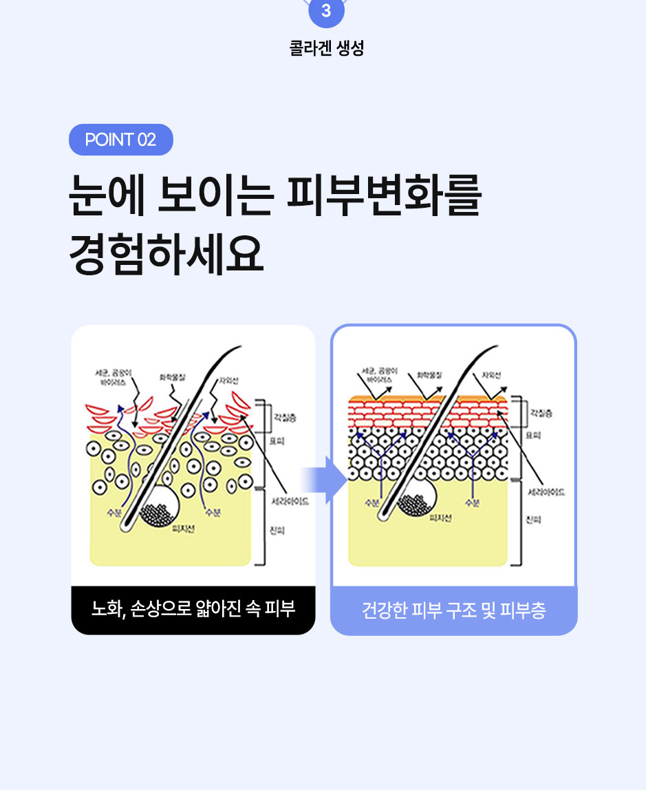 리쥬란4cc_미인하이_07.jpg