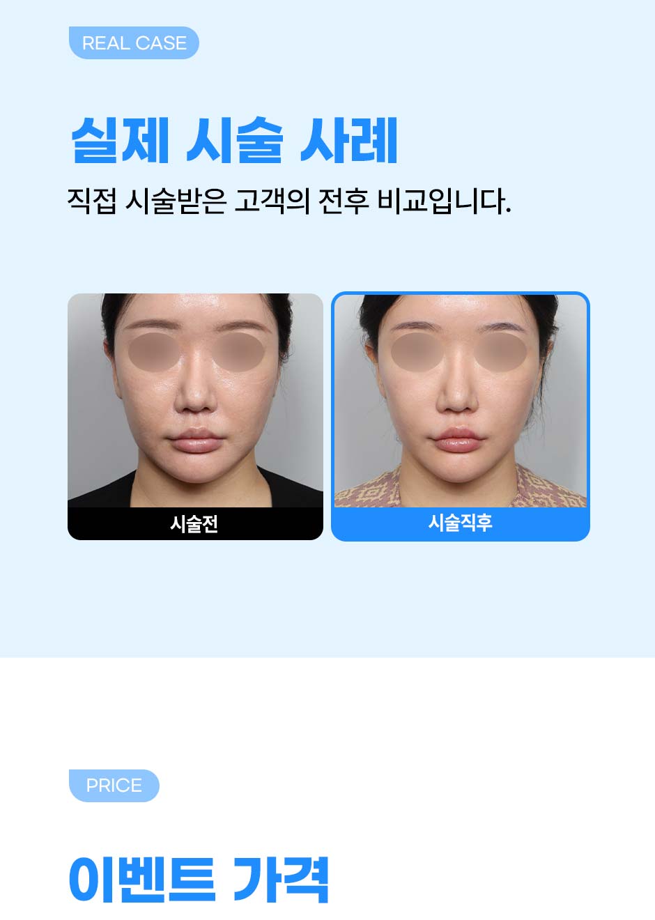 261001_실루엣재배치_미인하이_07.jpg