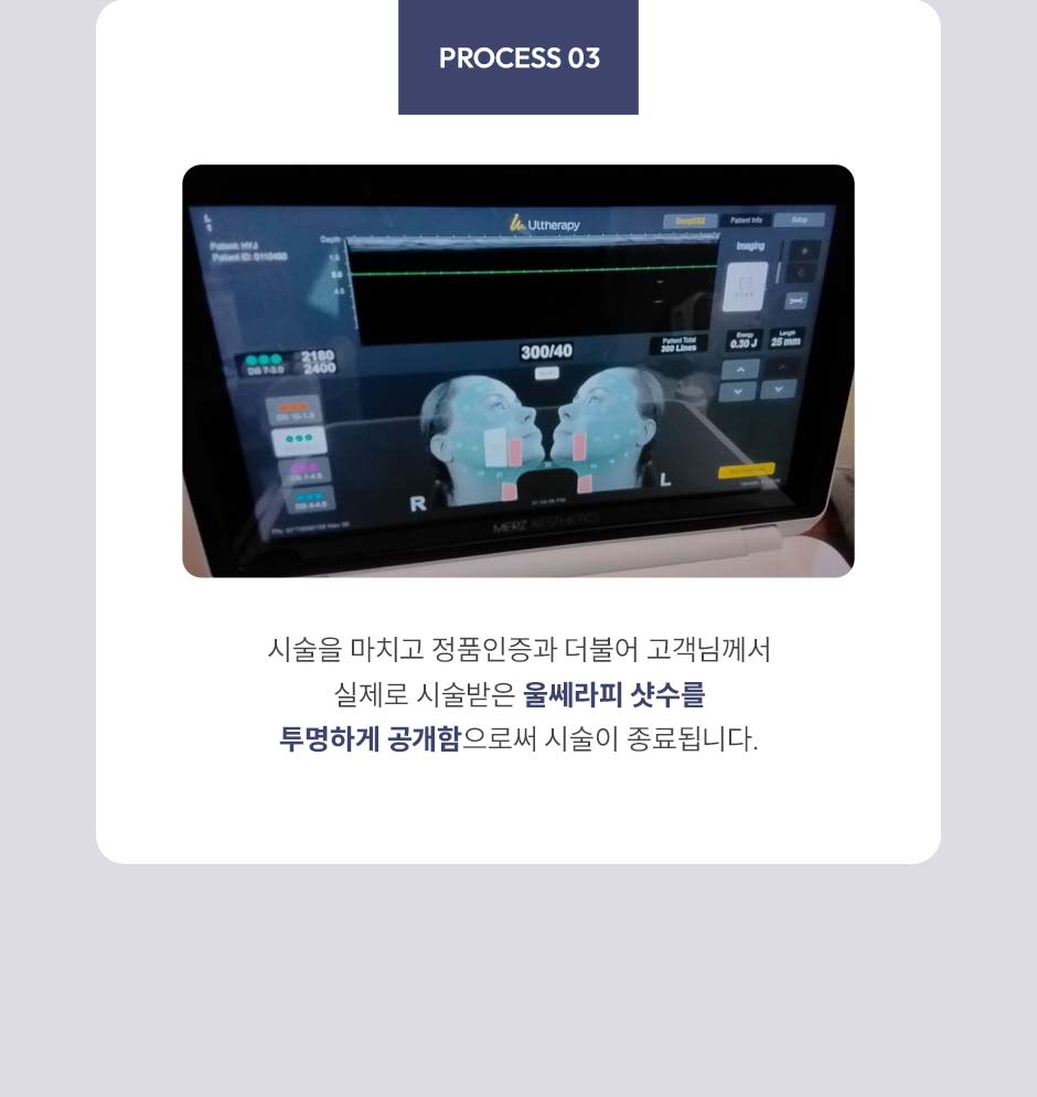 울쎄라피프라임_미인하이_07.jpg